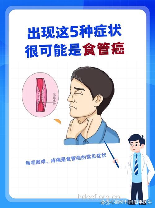 食道癌会出现哪些症状表现