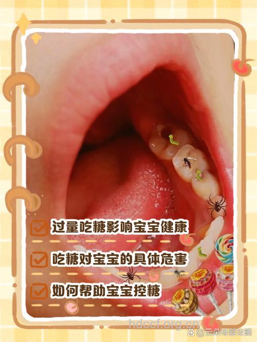 宝宝发烧吃糖有什么危害
