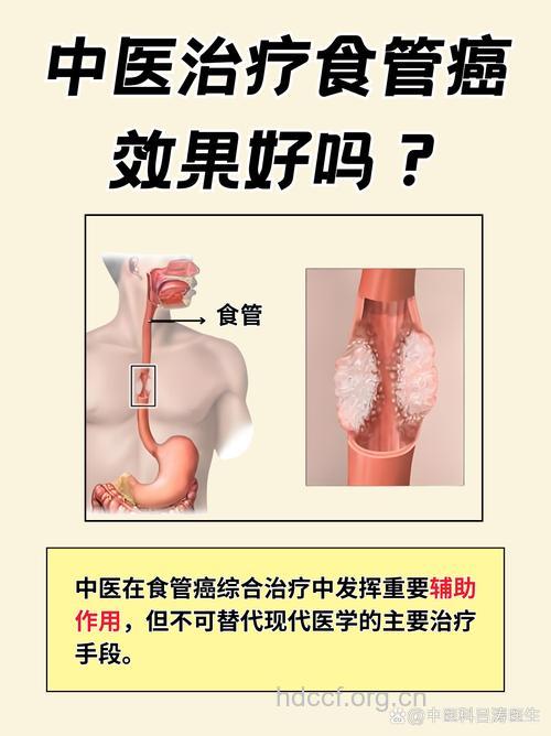 中医有哪些治疗食管癌方法