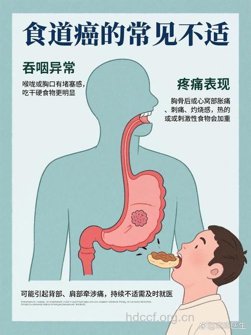 食道癌患者有疼痛感吗