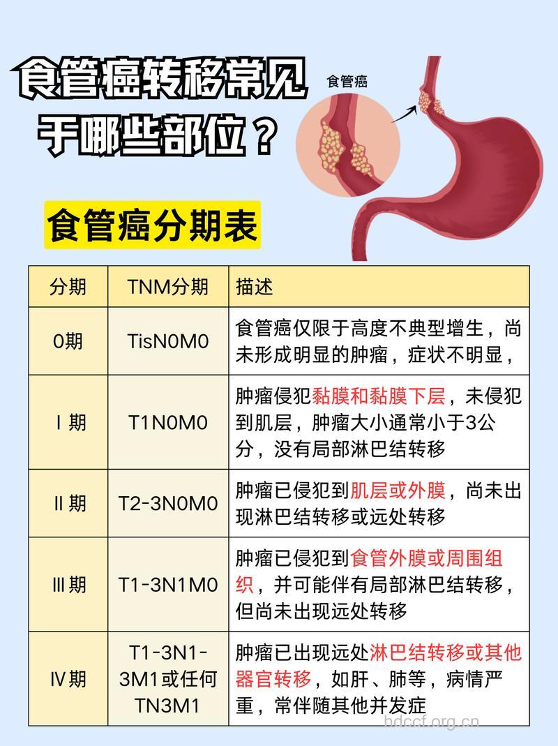 食道癌到了晚期会有哪些危害
