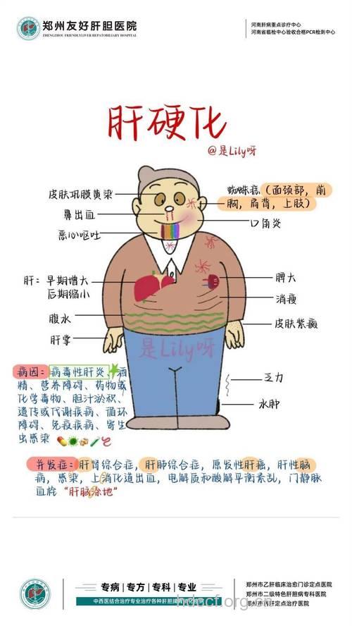 肝硬化内分泌时期有什么症状