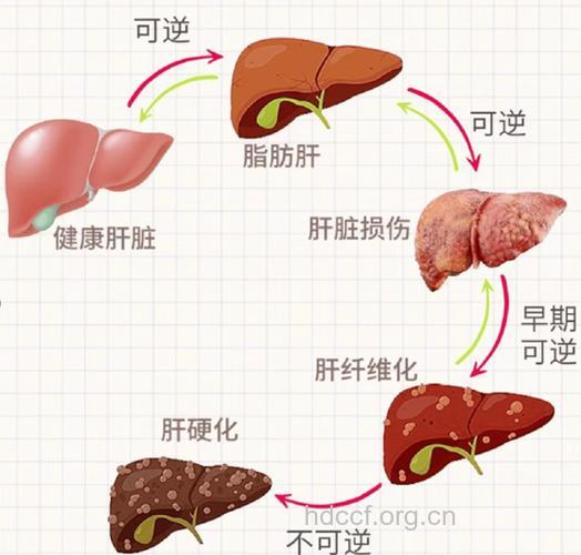 肝硬化和肝癌有什么关系