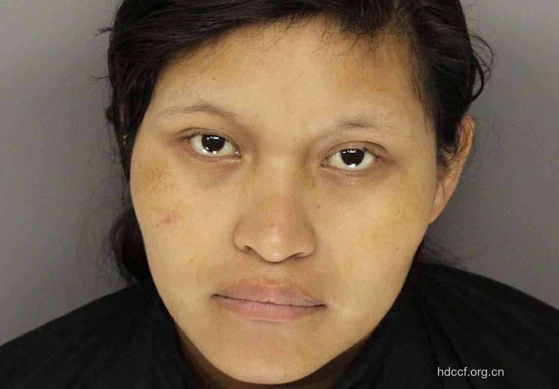 肝硬化为什么会引起脸色灰暗