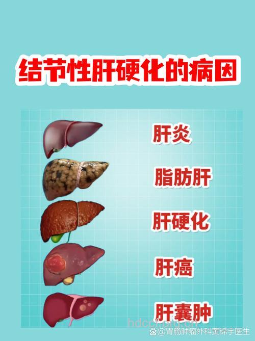 什么是结节性肝硬化