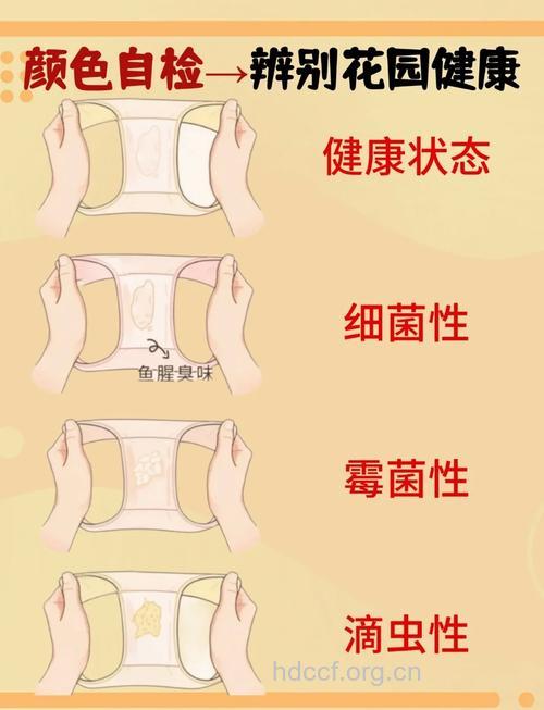 怎么从白带判断女性健康状况