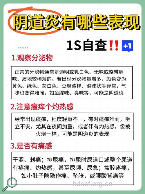 有哪些自我诊断阴道炎方法
