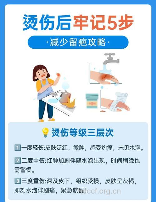 烧伤治疗有哪些常见误区