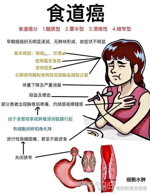 食道癌病情加重的原因