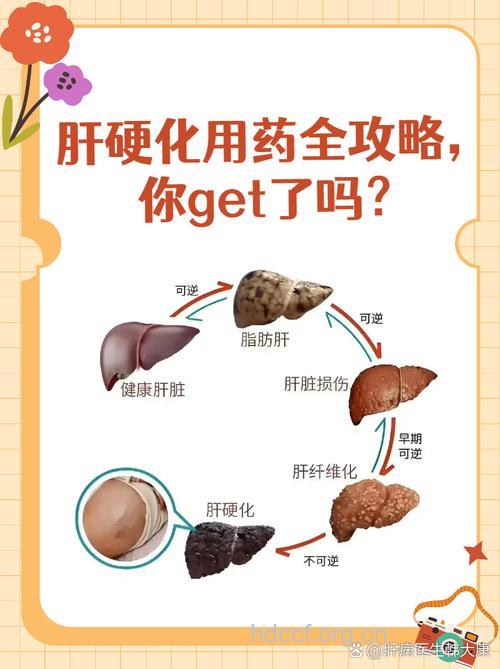 怎么用药治疗病毒性肝硬化方法