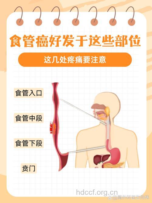 食道癌与烟酒也有关系