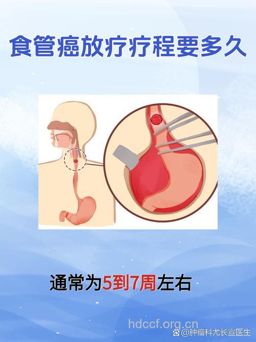 食道癌放疗有副作用吗