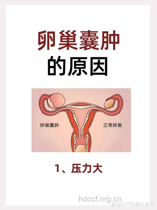 女性为什么会卵巢囊肿