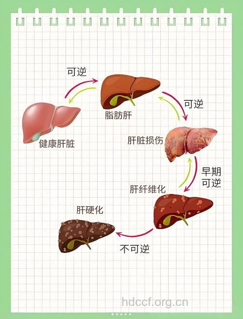 哪些人群容易患肝硬化