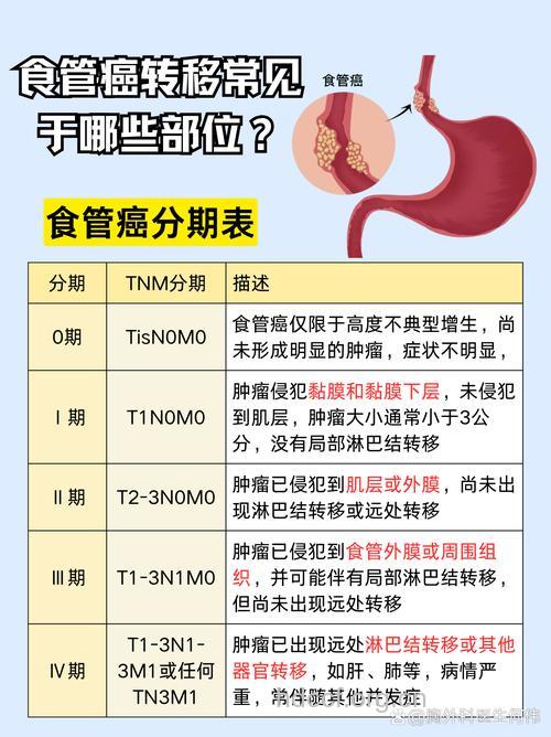 食道癌有什么病因