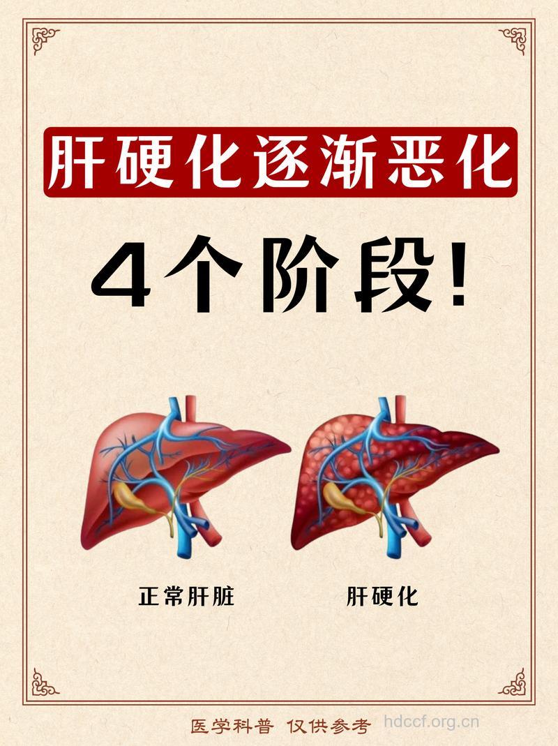 肝硬化病人莫死心