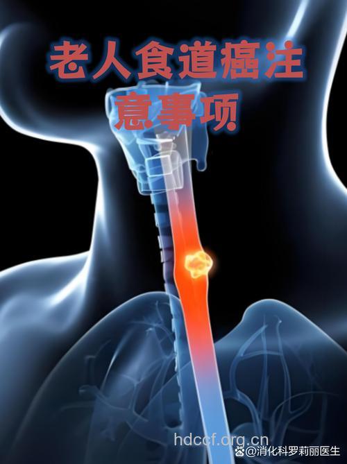 老人吞咽困难小心食道癌