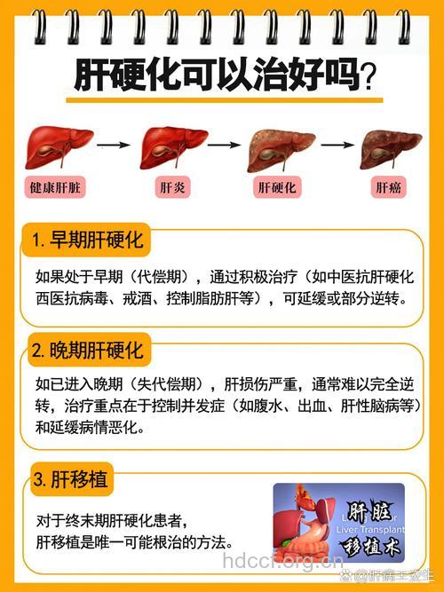 肝硬化能不能治疗?