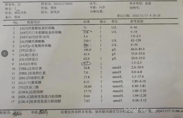 酒精性肝病的病理诊断标准