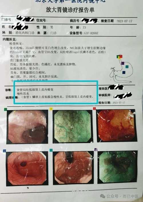 蒙藏医学药物治疗食管癌