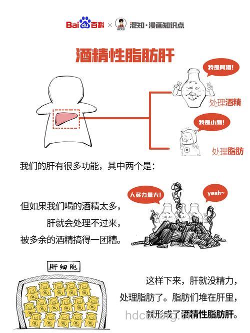 酒精性脂肪肝患者需解酒
