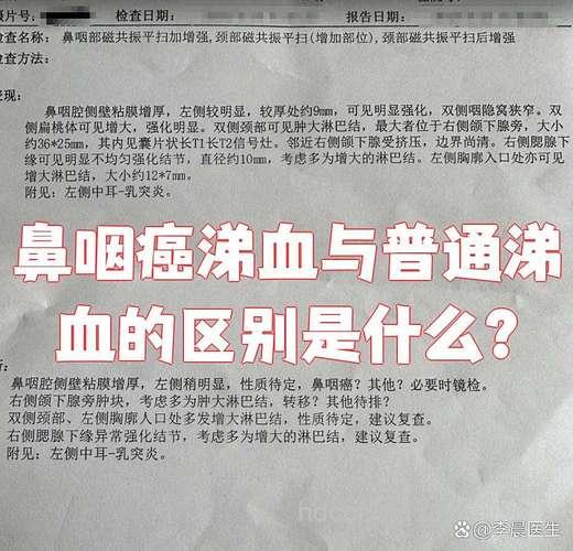 鼻咽癌的症状诊断是什么