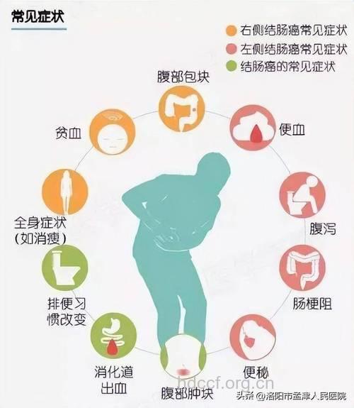 大肠癌的临床表现和体征
