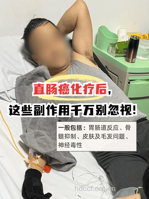 大肠癌放疗后有哪些副作用