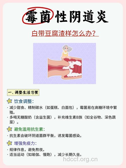 怎么饮食治疗白带异常