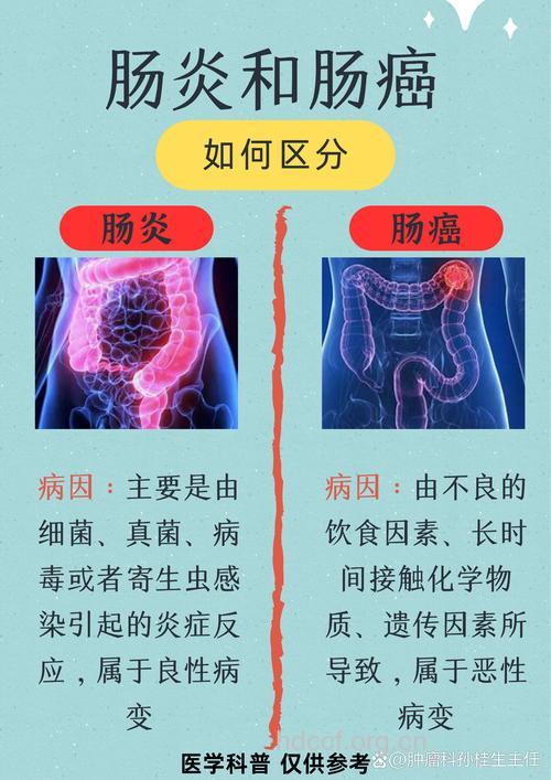 哪些是大肠肿瘤的症状