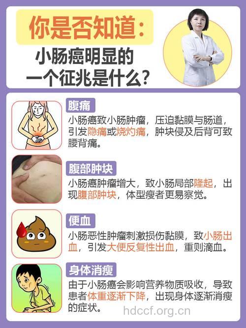 患上大肠癌最为典型的症状