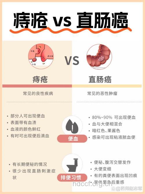 常见三种大肠癌的症状