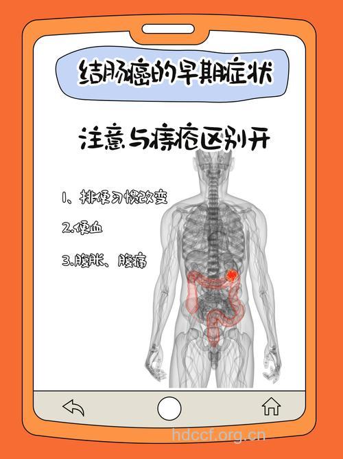 患了大肠癌的早期症状是什么