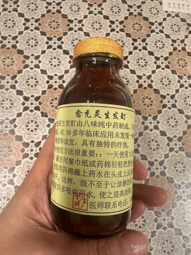 怎么用药酒外擦治疗斑秃