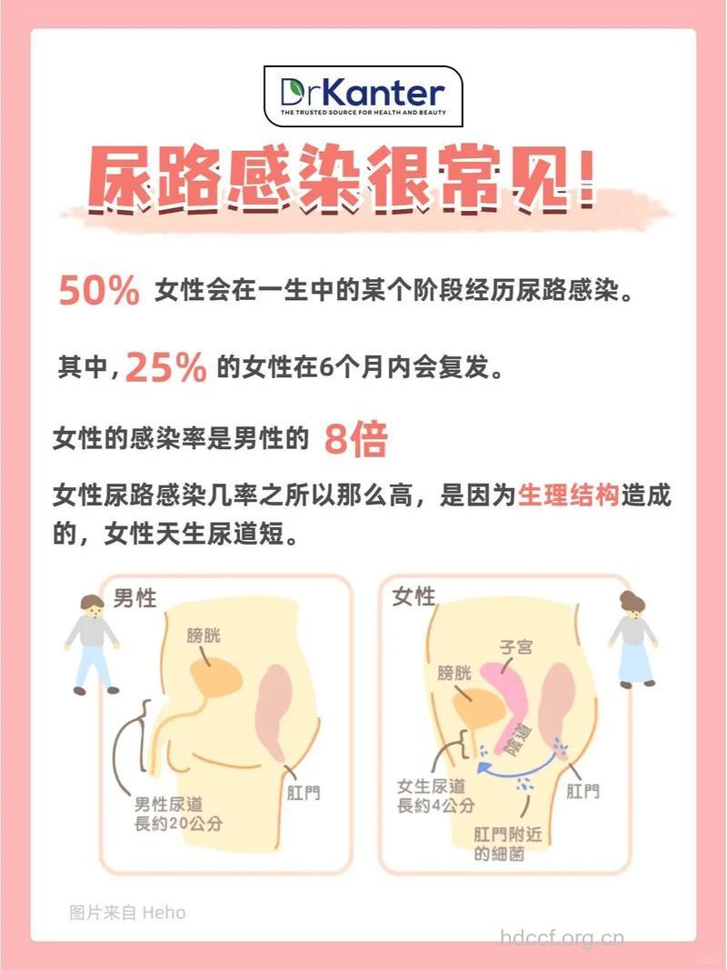 女性尿路感染了怎么办?