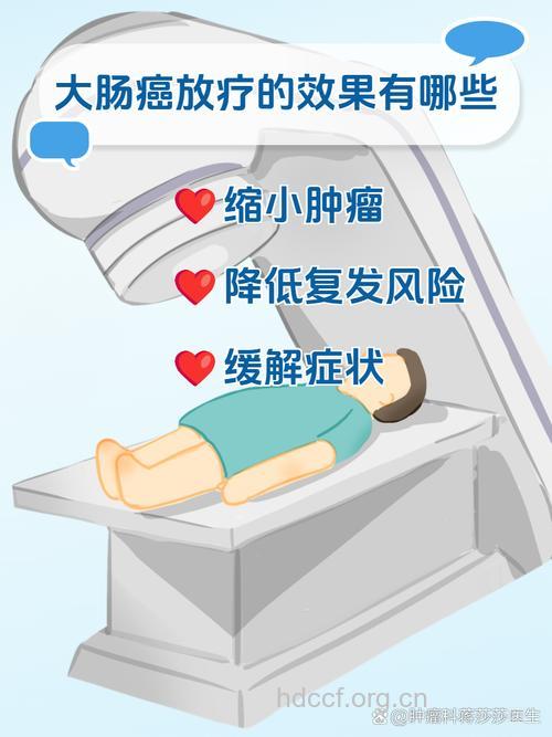 大肠癌的放射治疗怎么样