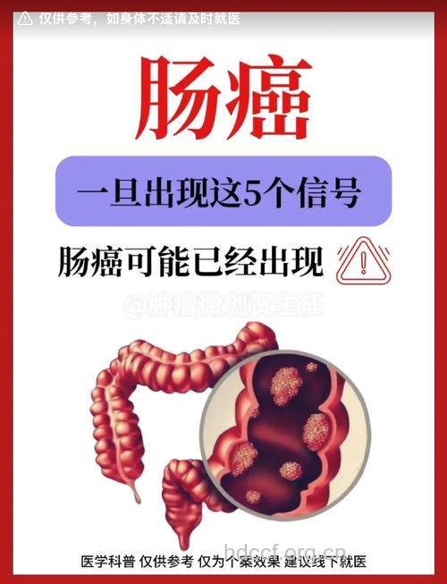 大肠癌的患者为何越来越多