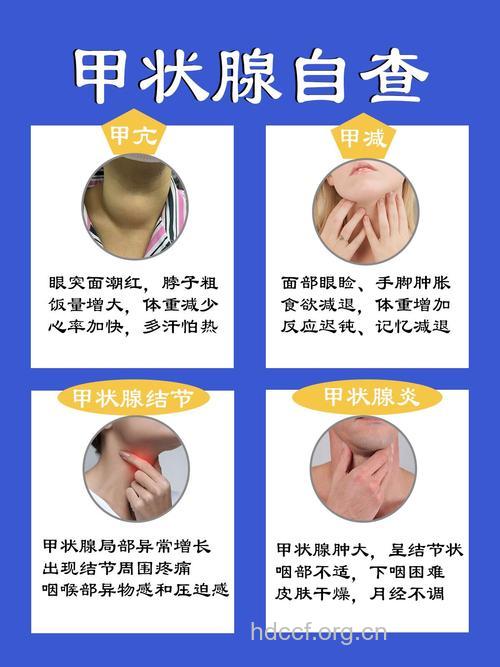 中医如何辩证治疗甲亢