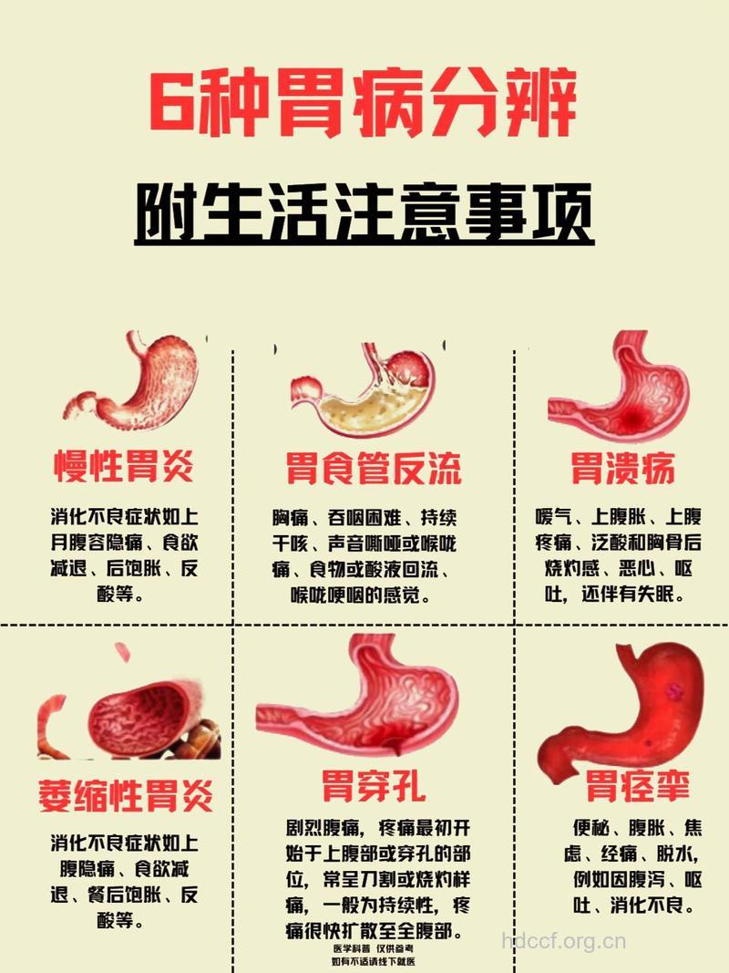 不同胃病饮食有何区别
