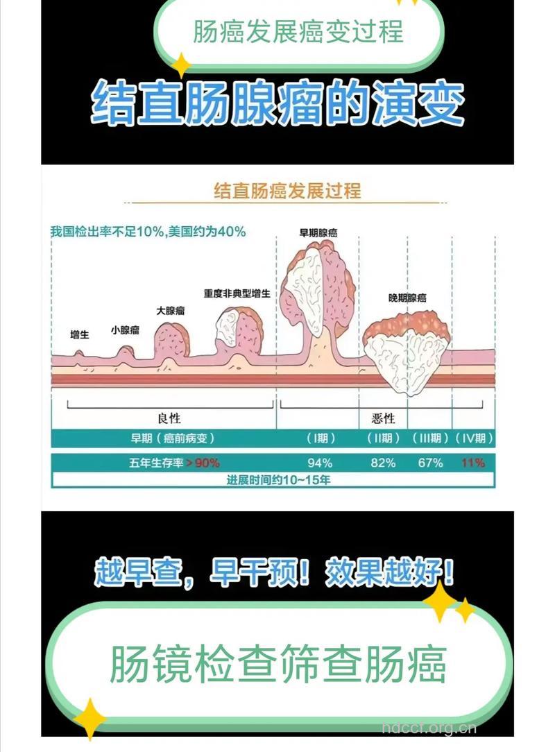 大肠癌是如何引发的呢