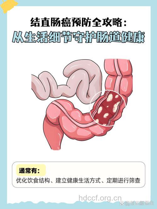 预防大肠癌要做到哪些