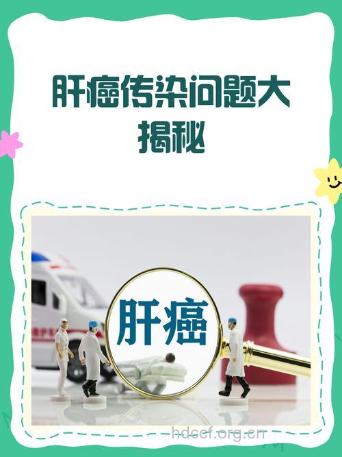 肝癌真的会遗传吗