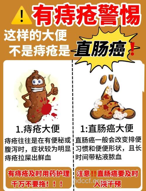 怎么从臭臭判断直肠癌方法