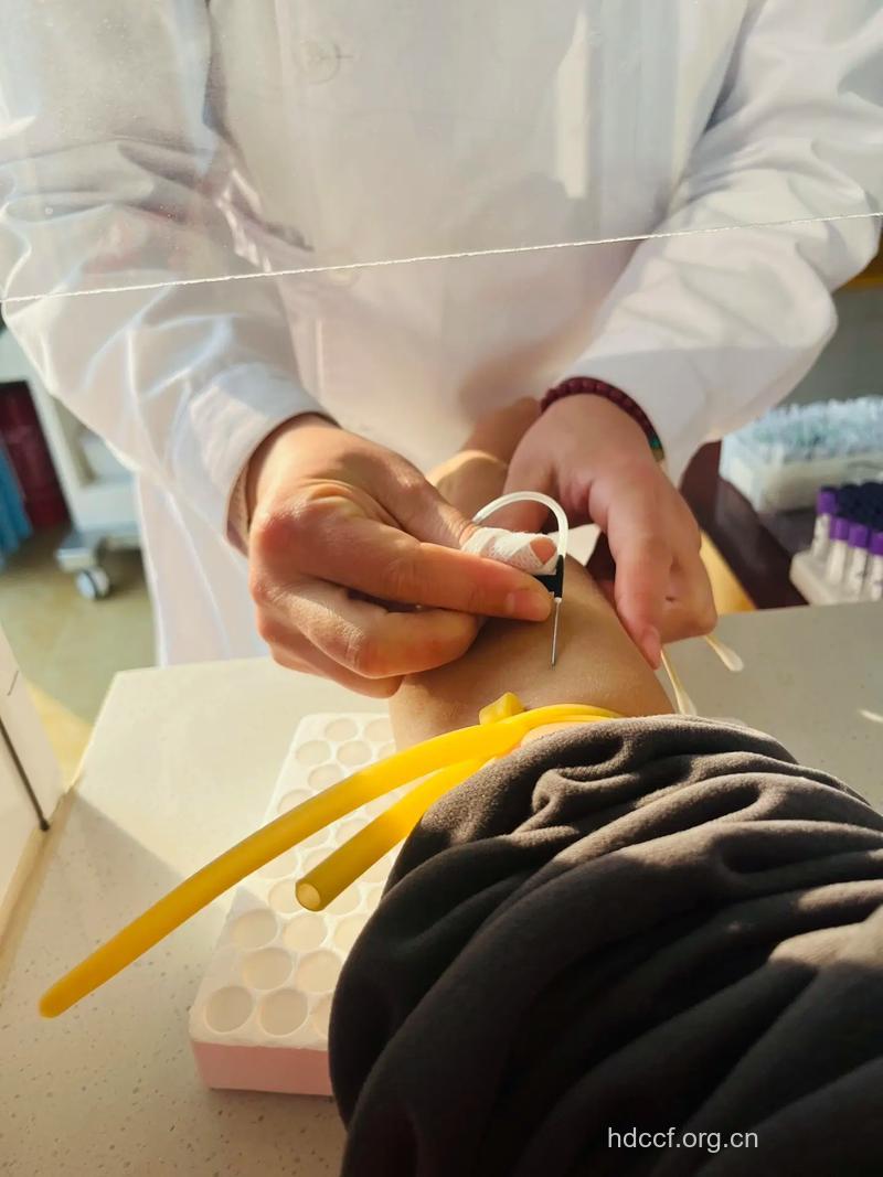 针灸治疗大肠癌的方法