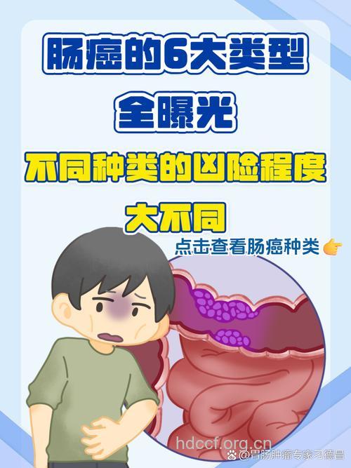 大肠癌的几大问题?