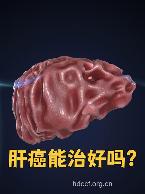 怎么判断肝癌手术治疗的效果