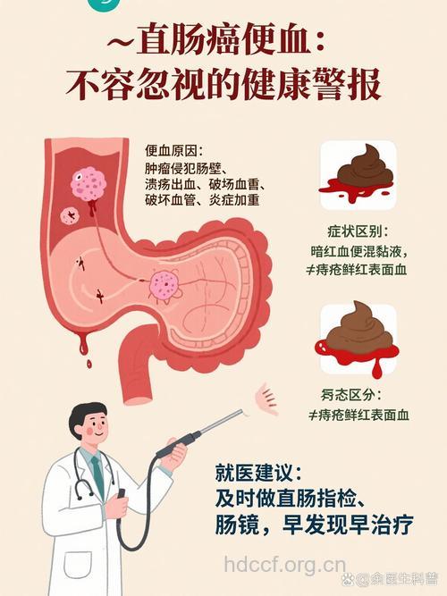频繁便血或是大肠癌早期征兆