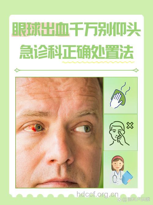 眼睛出血的几个常见的急救方式