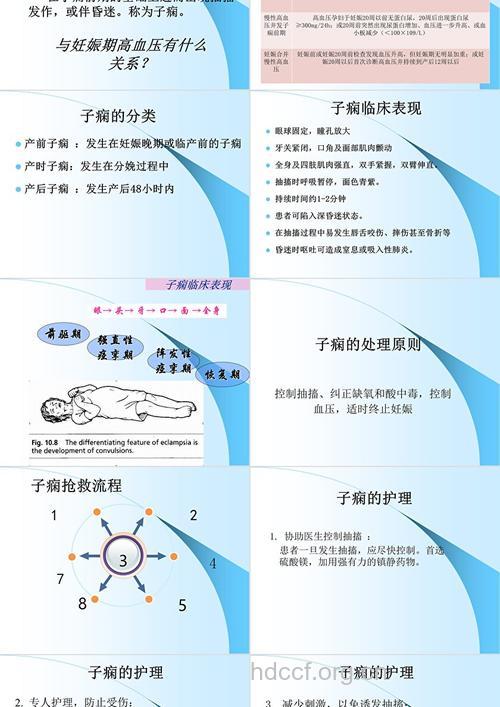 孕妇先兆子痫如何正确处理