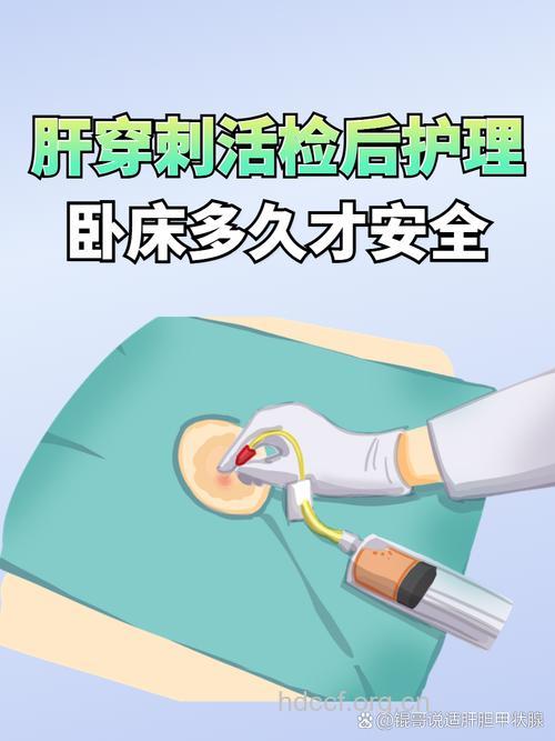 肝癌晚期有哪些基础护理